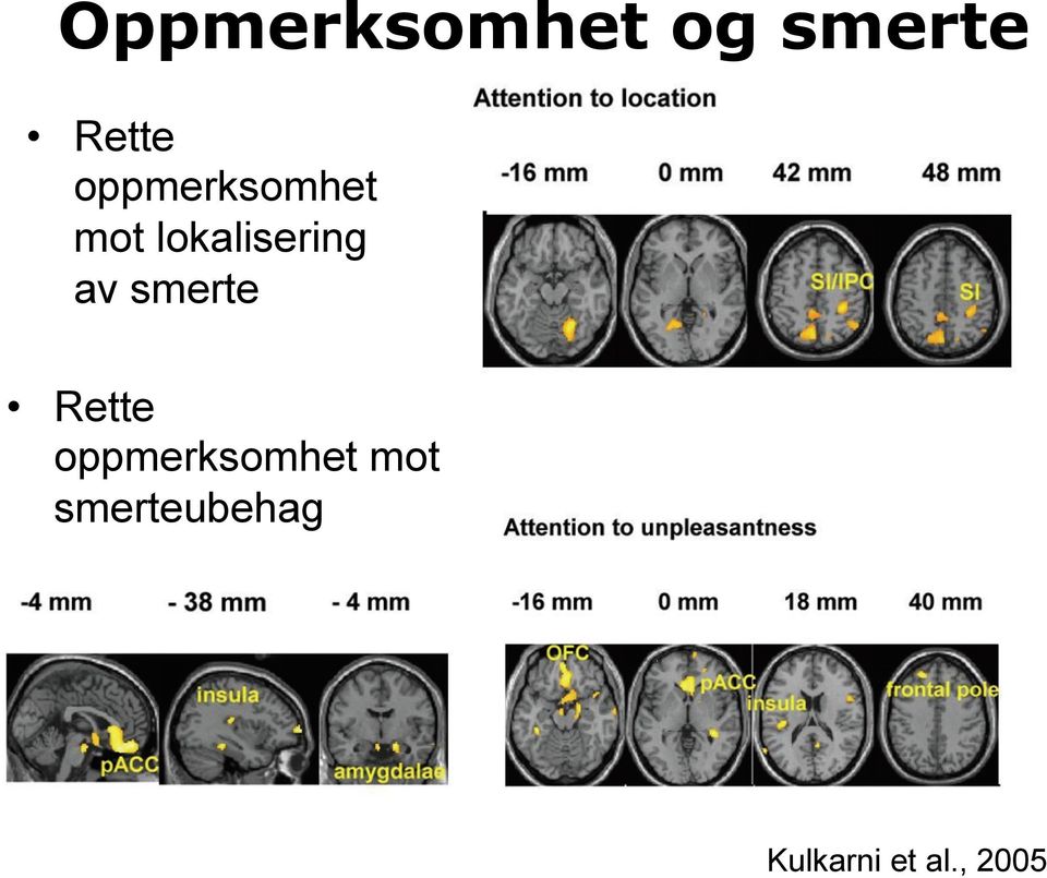 av smerte Rette oppmerksomhet