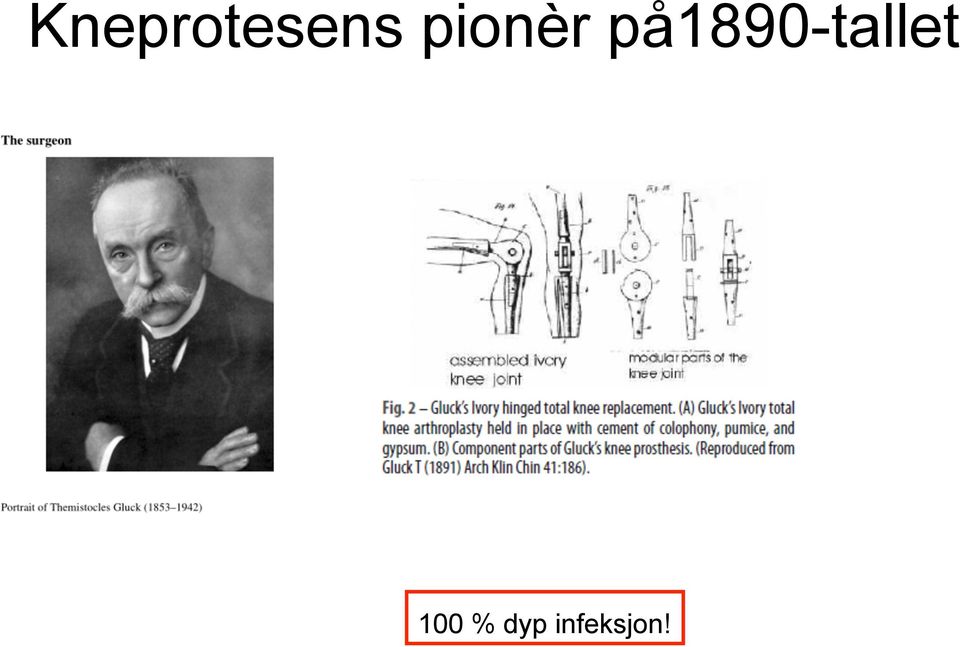 på1890-tallet