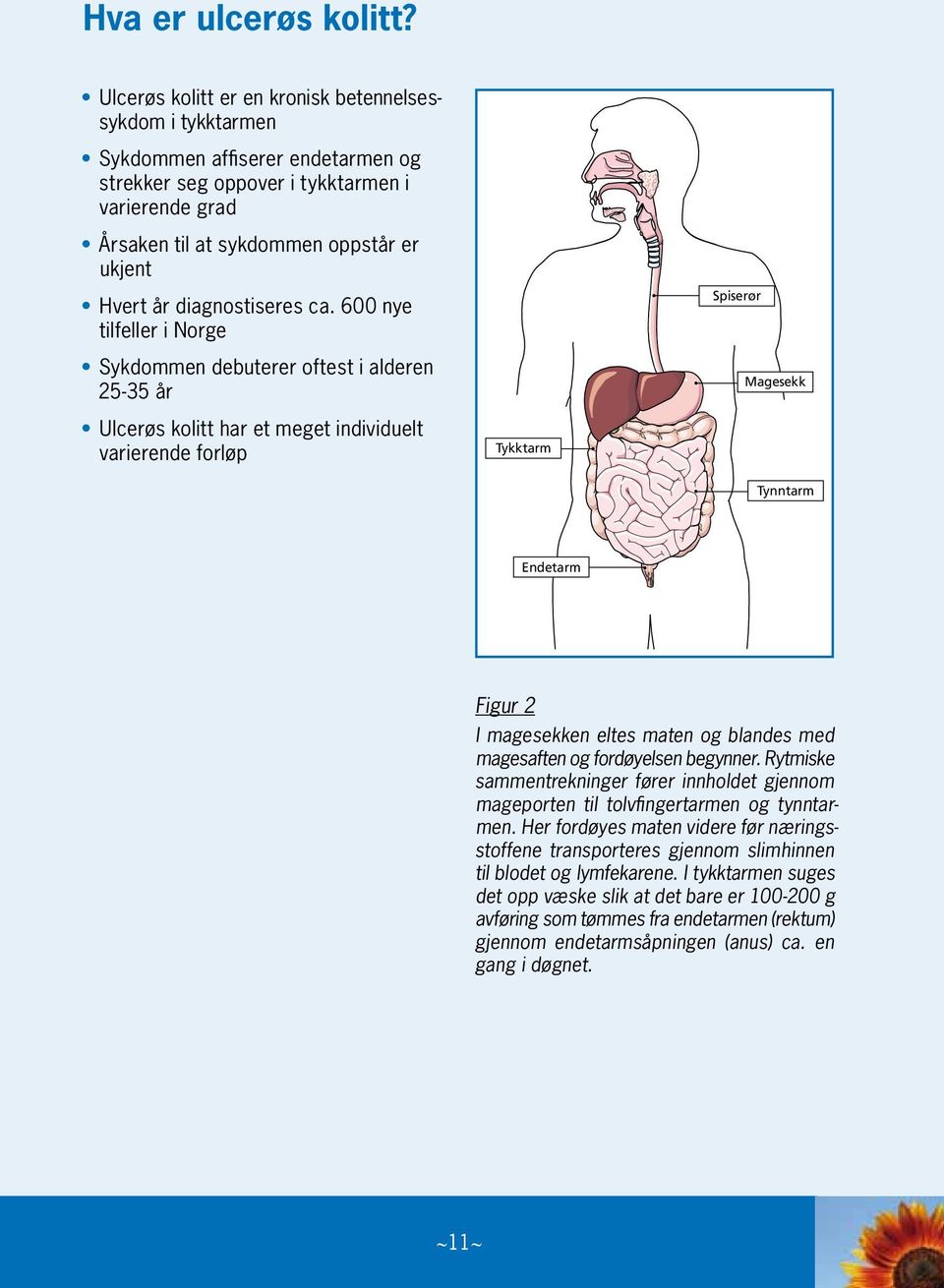 diagnostiseres ca.