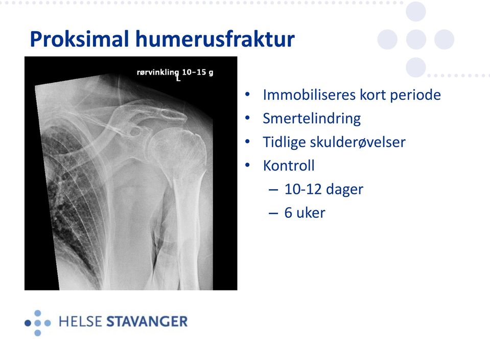 Smertelindring Tidlige