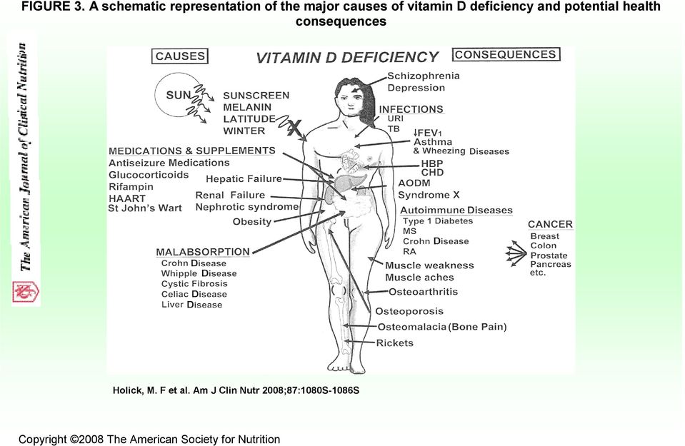 vitamin D deficiency and potential health consequences