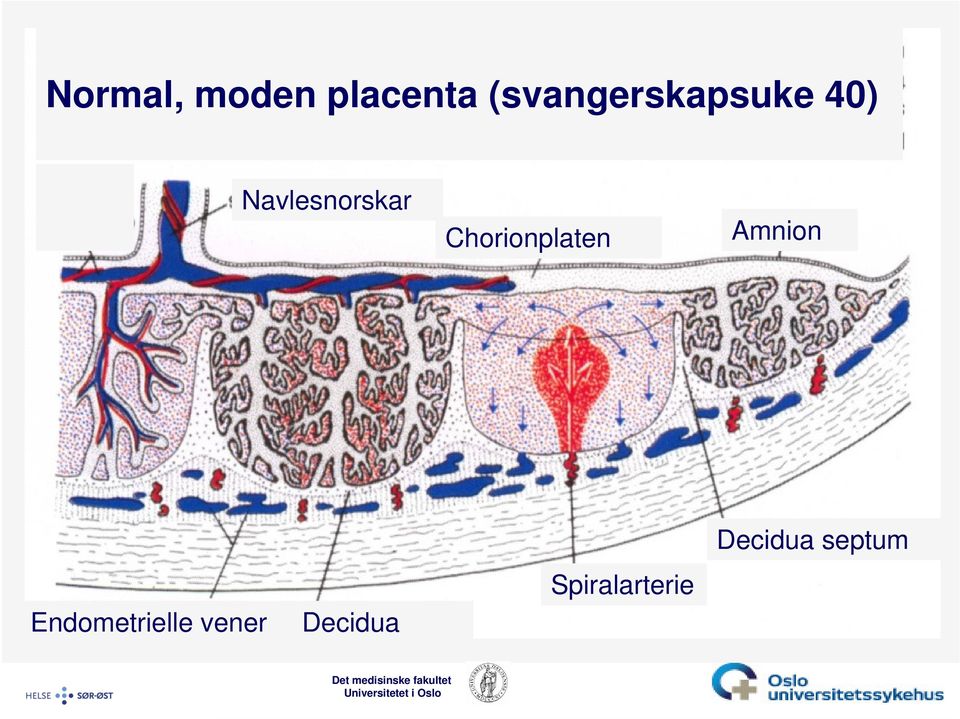 Navlesnorskar Chorionplaten