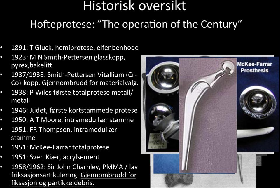 1938: P Wiles første totalprotese metall/ metall 1946: Judet, første kortstammede protese 1950: A T Moore, intramedullær stamme 1951: FR