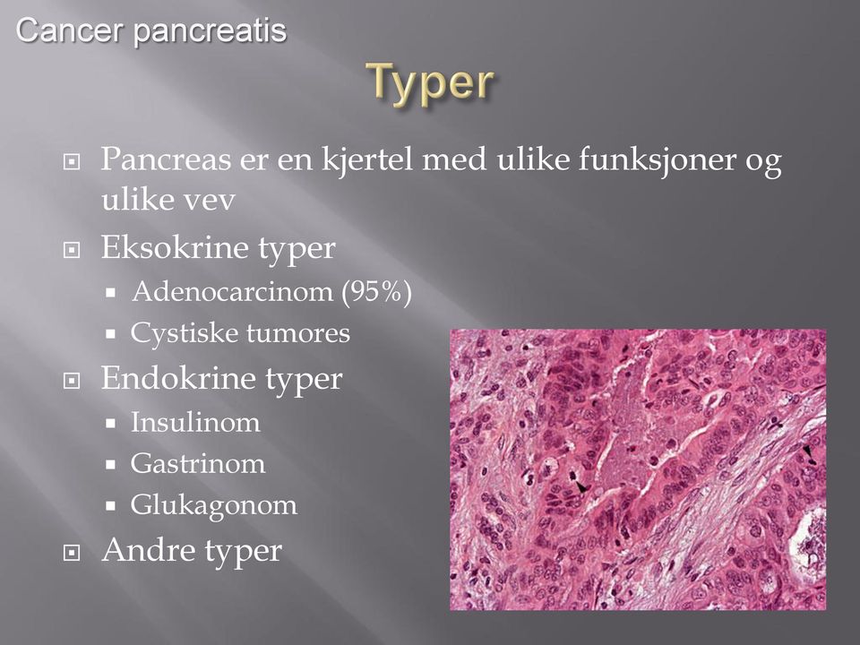 Adenocarcinom (95%) Cystiske tumores Endokrine