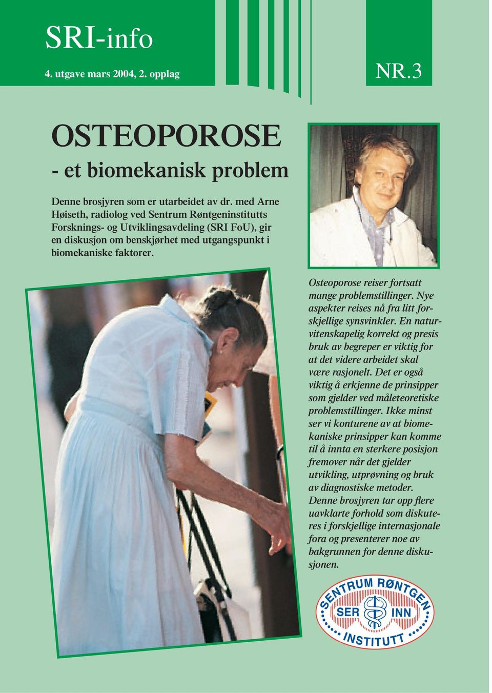 Osteoporose reiser fortsatt mange problemstillinger. Nye aspekter reises nå fra litt forskjellige synsvinkler.