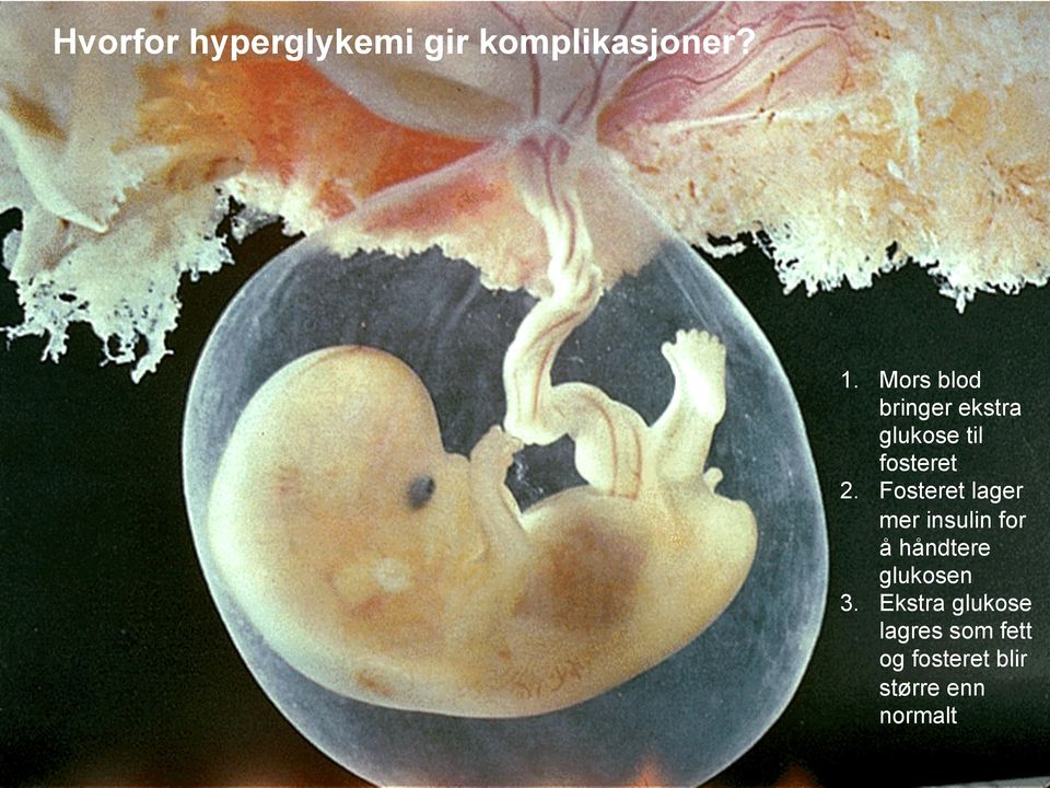 Fosteret lager mer insulin for å håndtere glukosen 3.