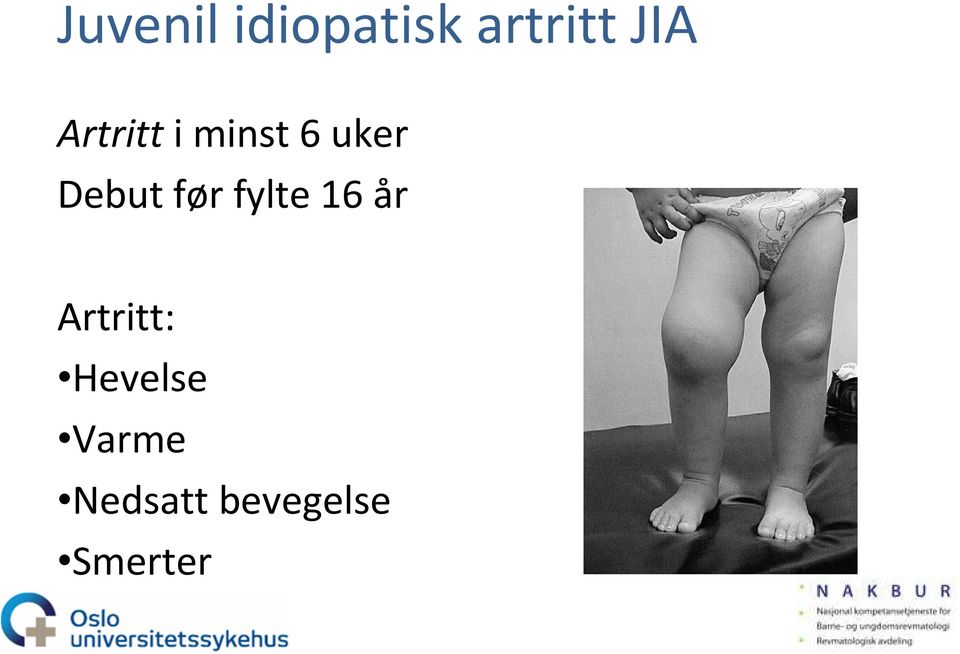 før fylte 16 år Artritt: