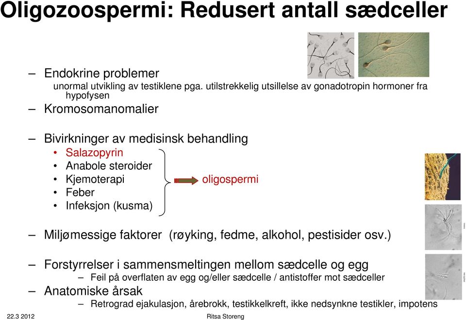 steroider Kjemoterapi oligospermi Feber Infeksjon (kusma) Miljømessige faktorer (røyking, fedme, alkohol, pestisider osv.