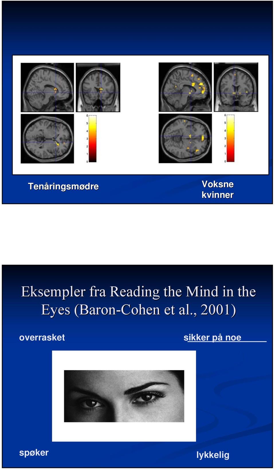the Eyes (Baron-Cohen et al.
