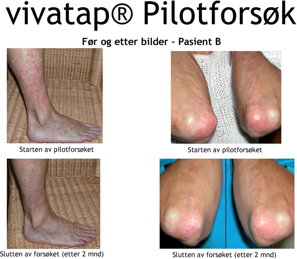 pilotforsøket Slutten av forsøket (etter 2 mnd)