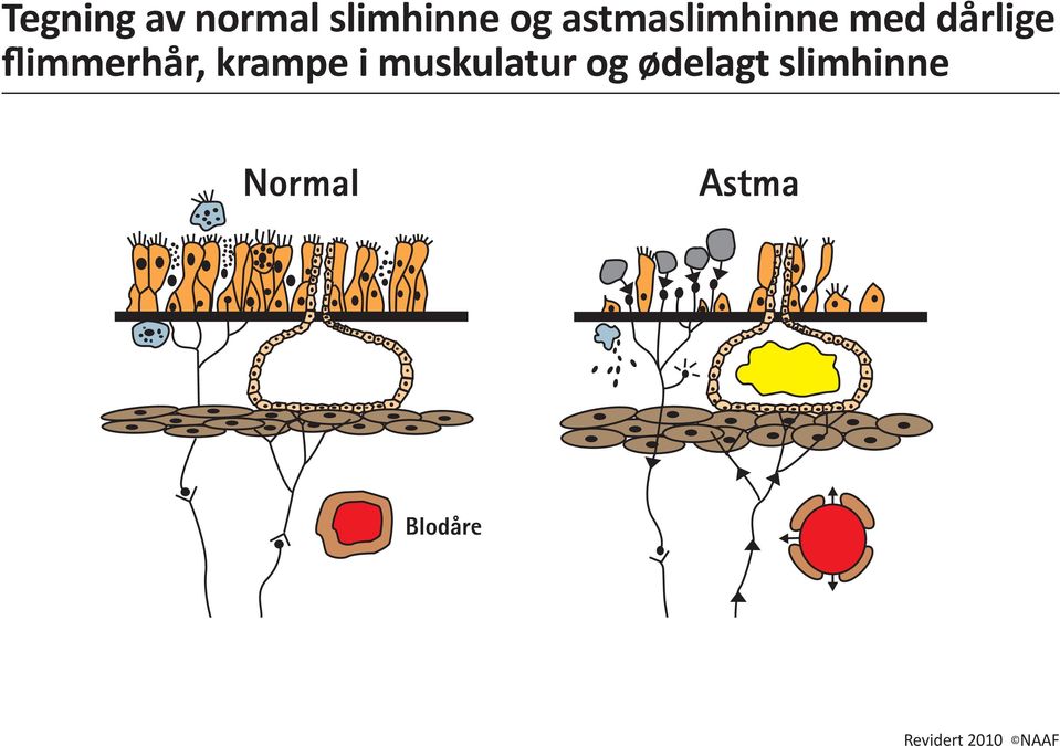 dårlige flimmerhår, krampe