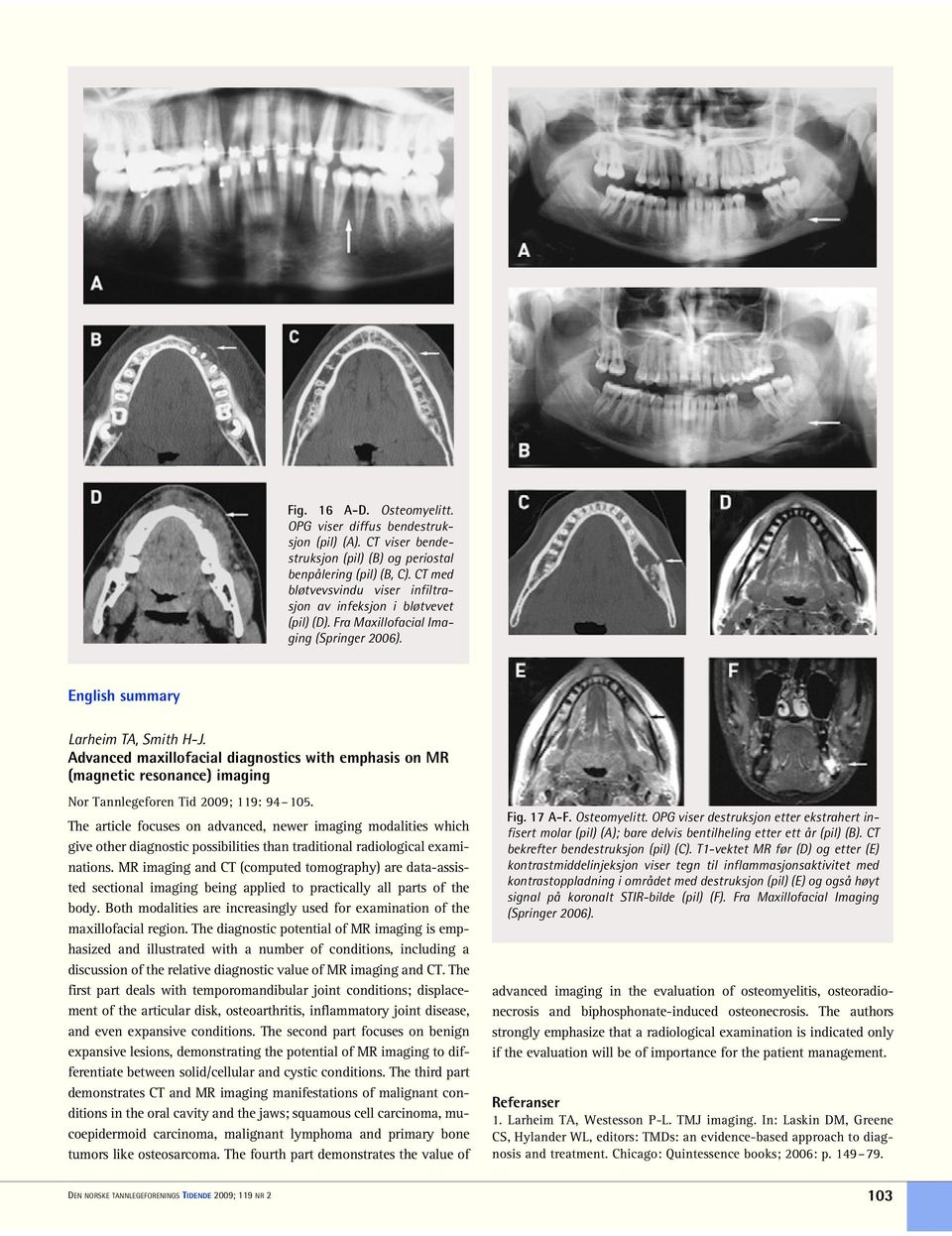 Advanced maxillofacial diagnostics with emphasis on MR (magnetic resonance) imaging Nor Tannlegeforen Tid 2009; 119: 94 105.