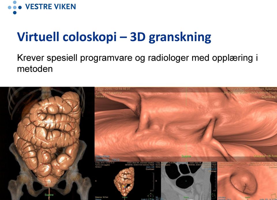 spesiell programvare og