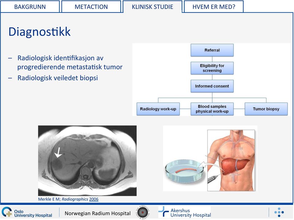 progredierende metasta5sk tumor Radiologisk