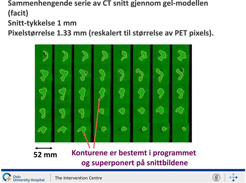 33 mm (reskalert til størrelse av PET pixels).