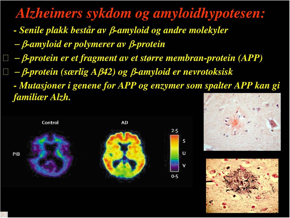 et større membran-protein (APP) β-protein (særlig Aβ42) og β-amyloid er