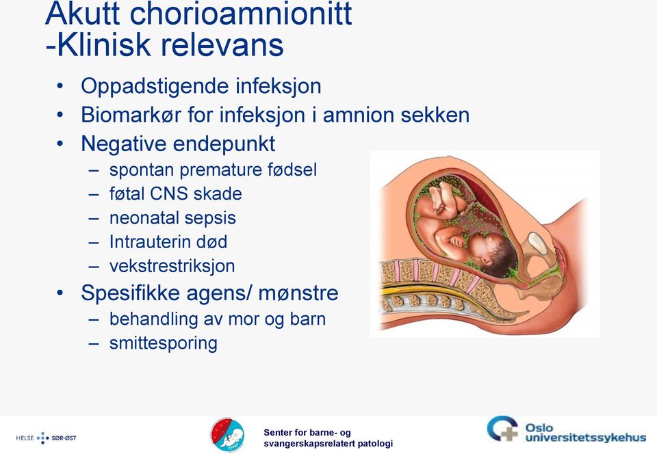 premature fødsel føtal CNS skade neonatal sepsis Intrauterin død