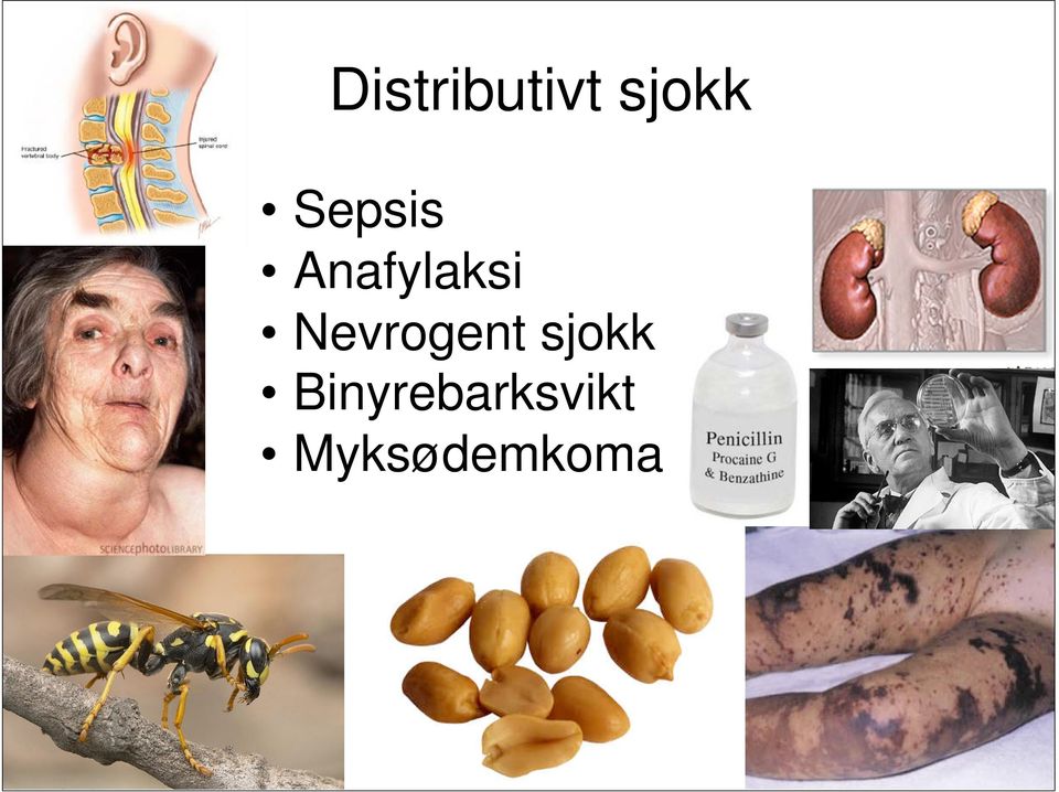 Nevrogent sjokk