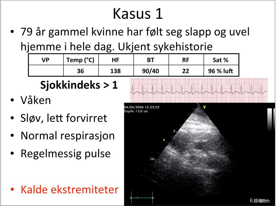 Ukjent sykehistorie VP Temp ( C) HF BT RF Sat % Sjokkindeks > 1