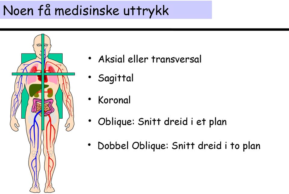 Oblique: Snitt dreid i et plan