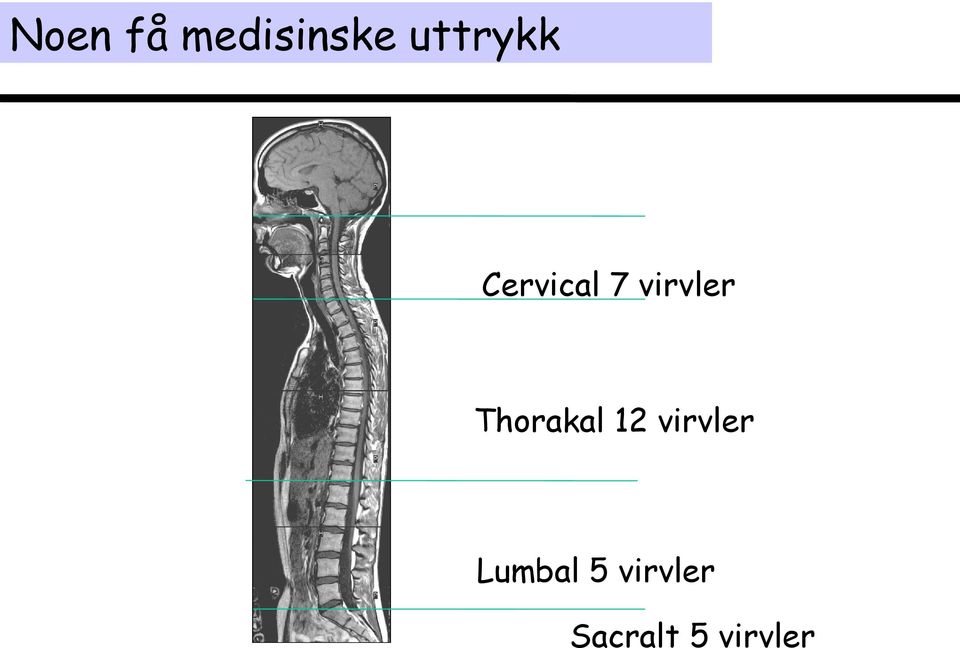 virvler Thorakal 12