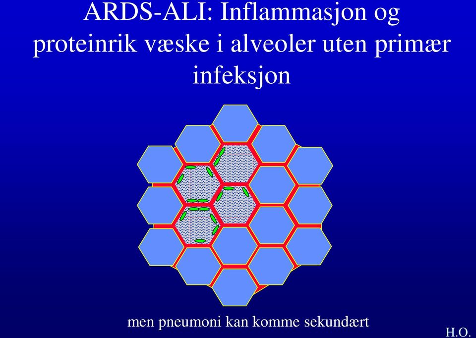 alveoler uten primær