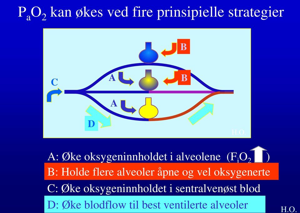 alveoler åpne og vel oksygenerte C: Øke oksygeninnholdet i