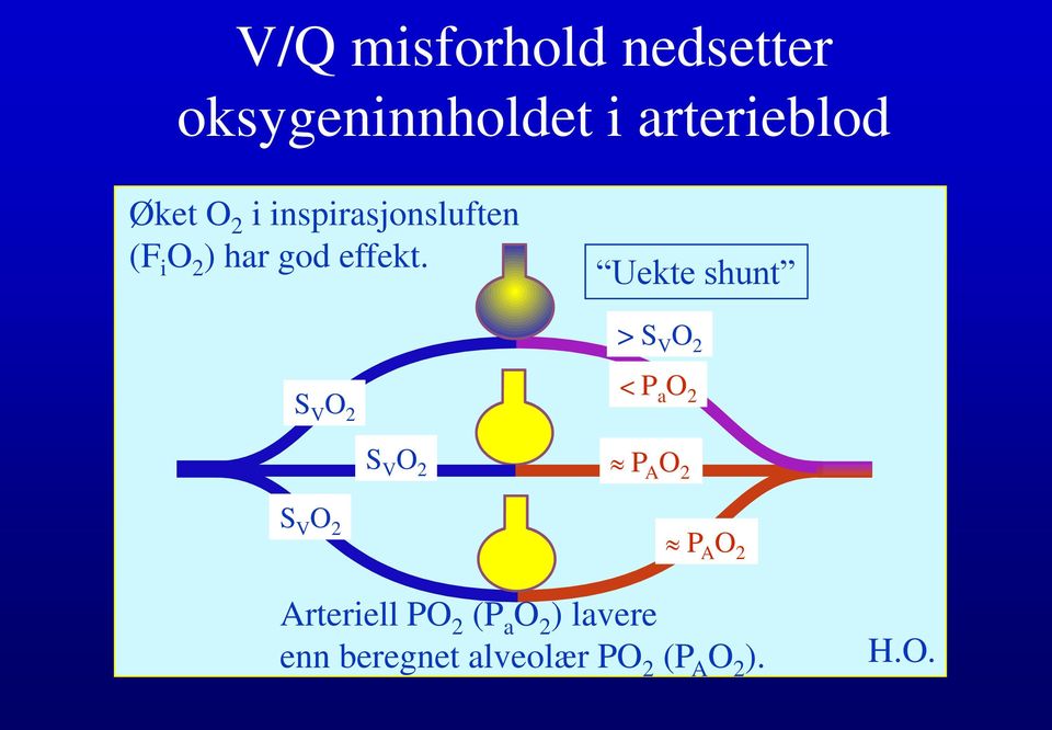 Uekte shunt > S V O 2 S V O 2 < P a O 2 S V O 2 P A O 2 S V O 2