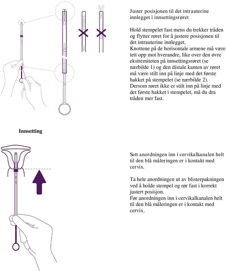 det første hakket på stempelet (se nærbilde 2). Dersom røret ikke er stilt inn på linje med det første hakket i stempelet, må du dra tråden mer fast.