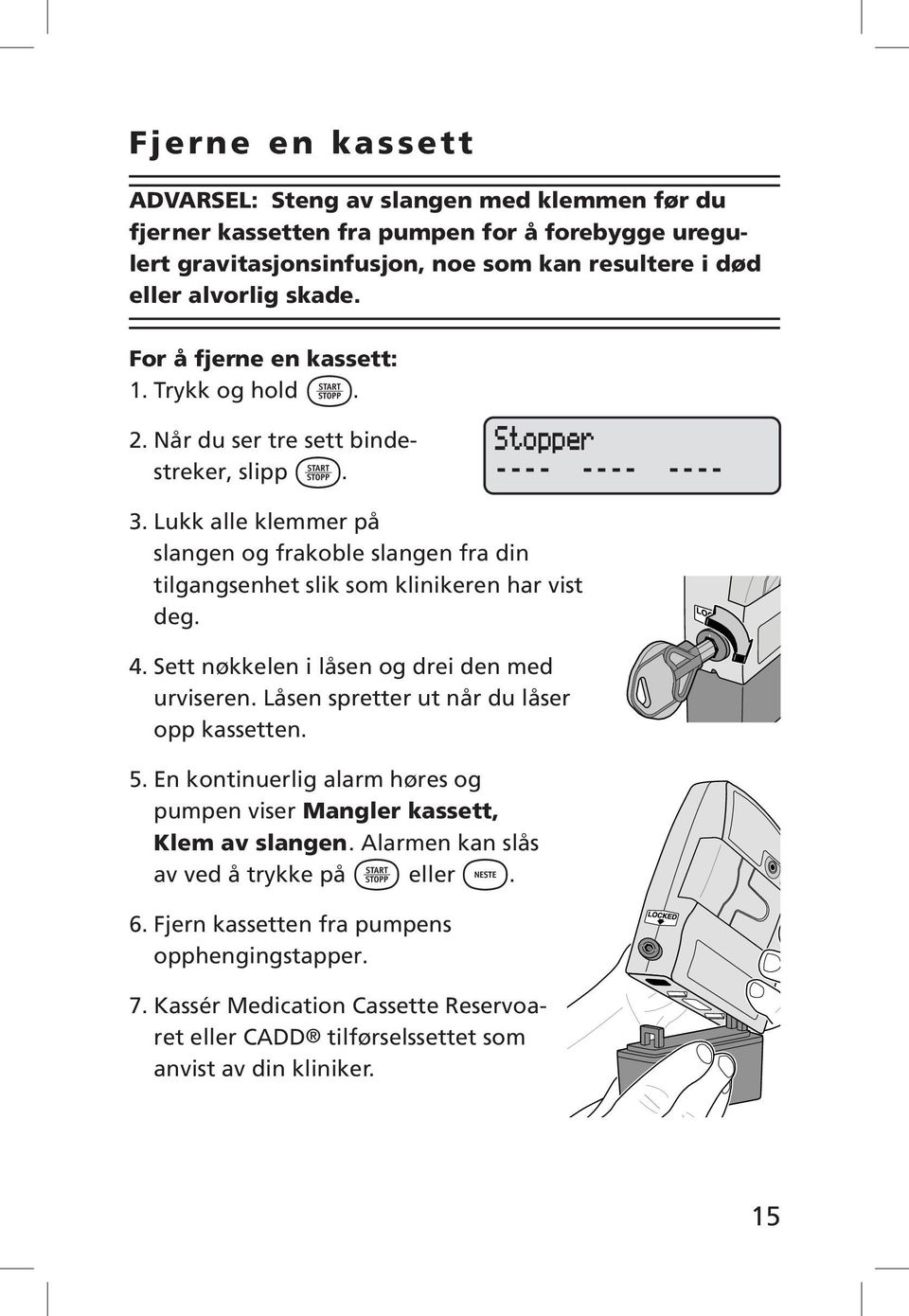 Lukk alle klemmer på slangen og frakoble slangen fra din tilgangsenhet slik som klinikeren har vist deg. 1998-12-16 D. Zurn «Lgc Unlock Key» 4. Sett nøkkelen i låsen og drei den med urviseren.