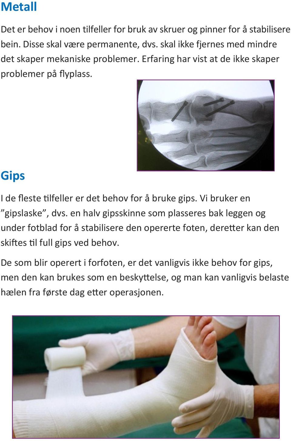 Gips I de fleste tilfeller er det behov for å bruke gips. Vi bruker en gipslaske, dvs.