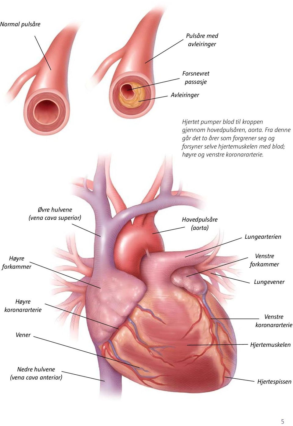 Fra denne går det to årer som forgrener seg og forsyner selve hjertemuskelen med blod; høyre og venstre koronararterie.