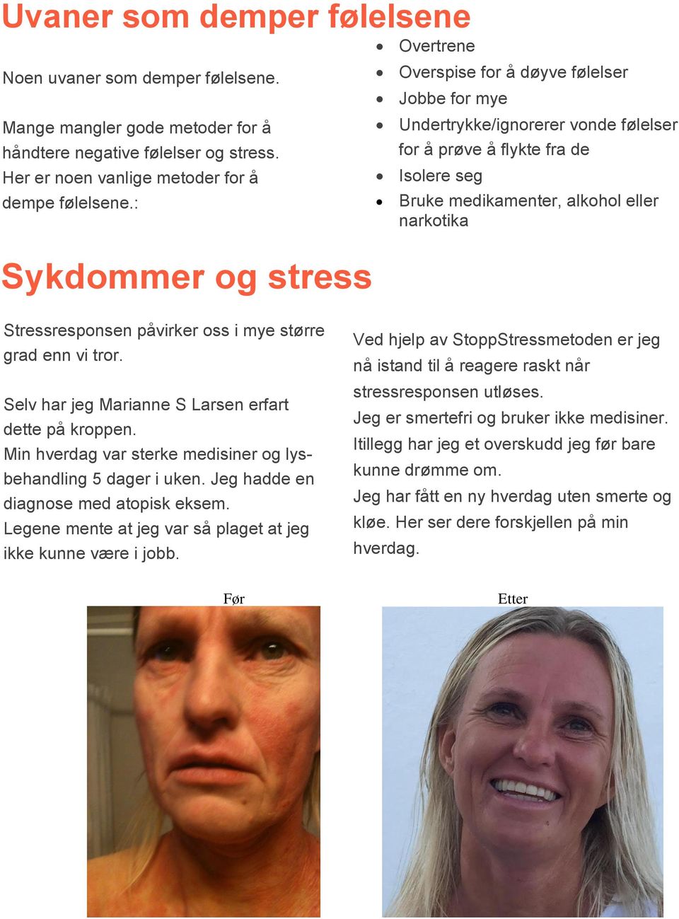 Stressresponsen påvirker oss i mye større grad enn vi tror. Selv har jeg Marianne S Larsen erfart dette på kroppen. Min hverdag var sterke medisiner og lysbehandling 5 dager i uken.