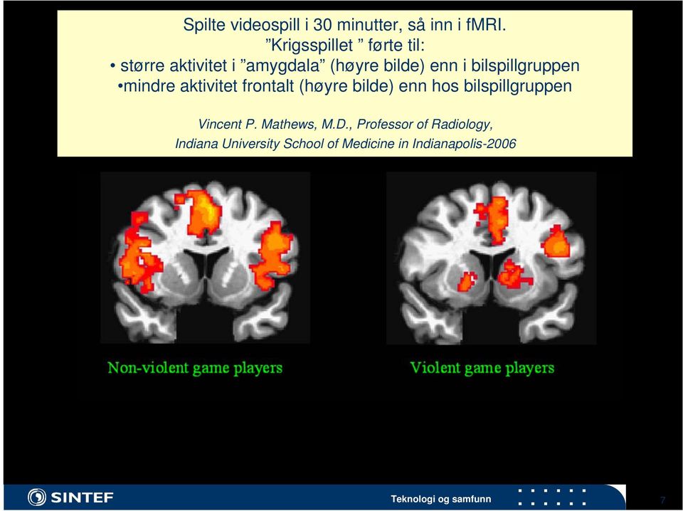 bilspillgruppen mindre aktivitet frontalt (høyre bilde) enn hos bilspillgruppen