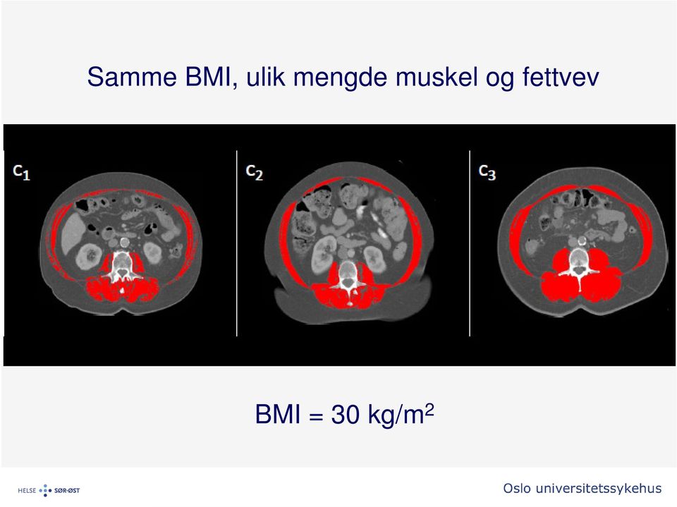 muskel og