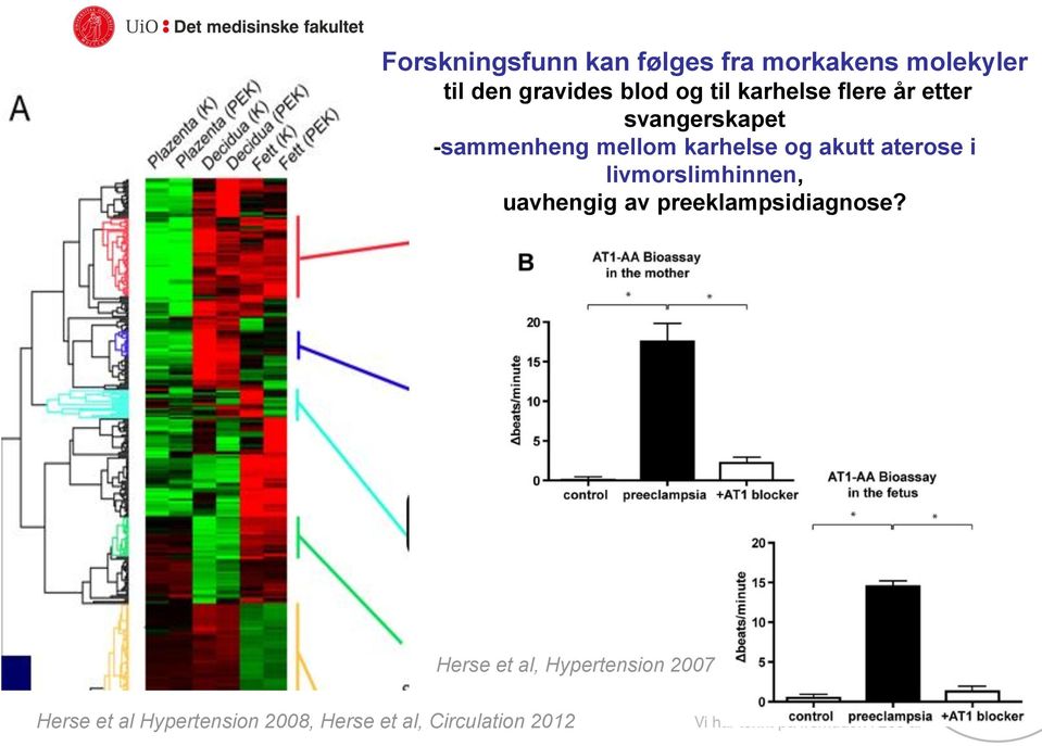 akutt aterose i livmorslimhinnen, uavhengig av preeklampsidiagnose?