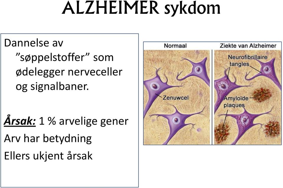 nerveceller og signalbaner.