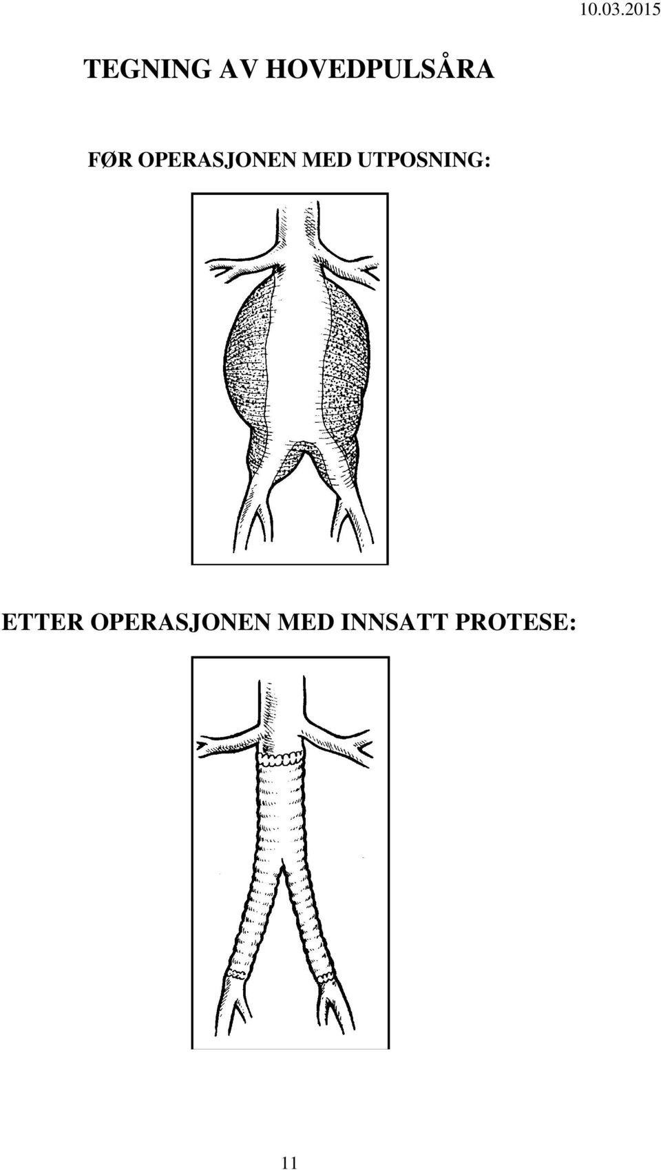 UTPOSNING: ETTER