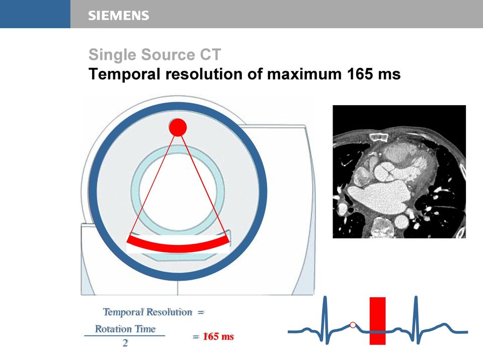 ms Temporal Resolution =