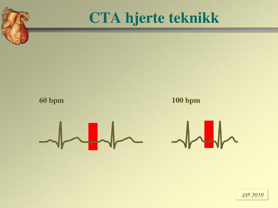 teknikk