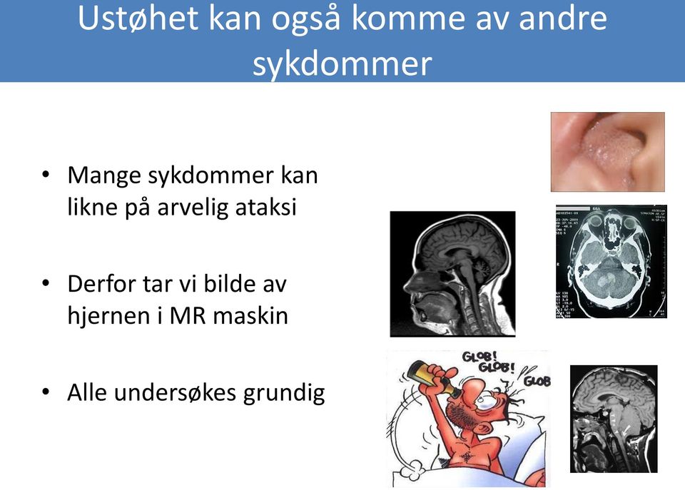 på arvelig ataksi Derfor tar vi bilde