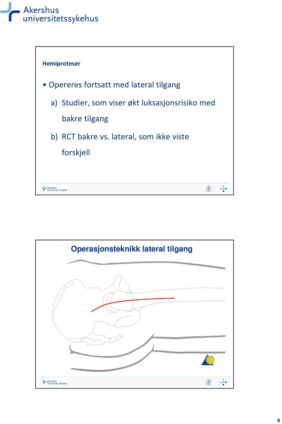 luksasjonsrisiko med bakre tilgang b) RCT bakre