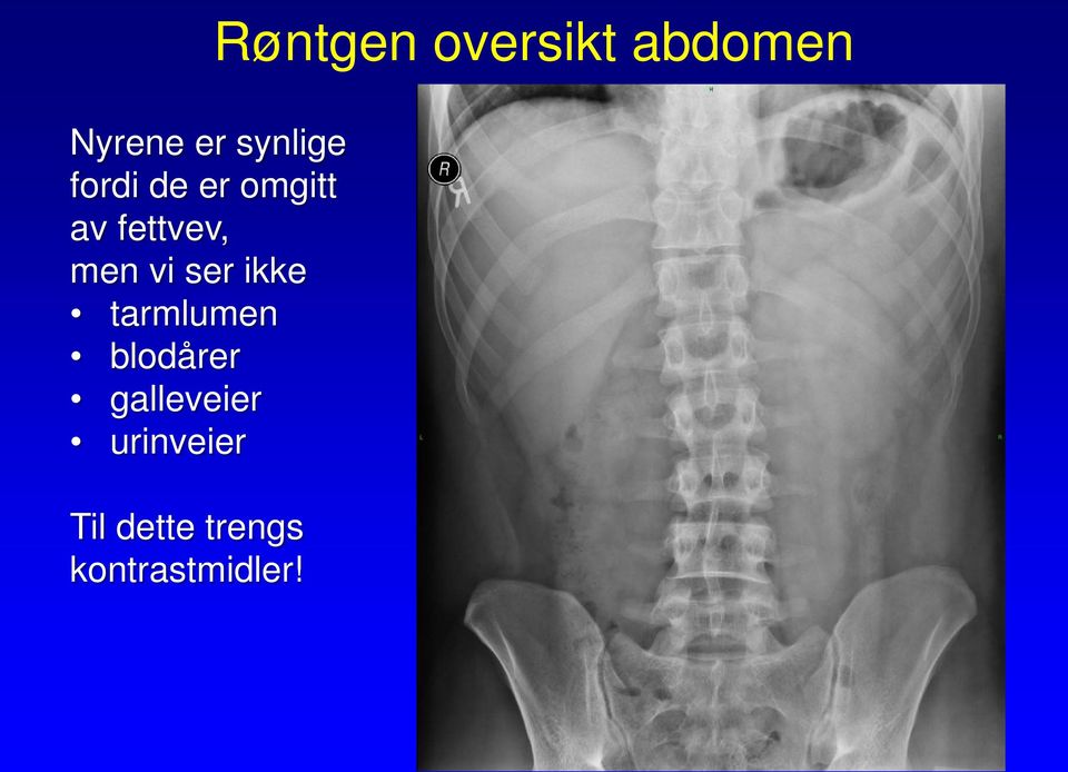 blodårer galleveier urinveier Til dette