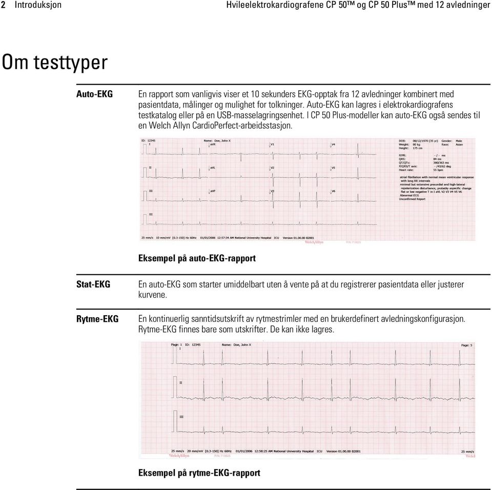 I CP 50 Plus-modeller kan auto-ekg også sendes til en Welch Allyn CardioPerfect-arbeidsstasjon.