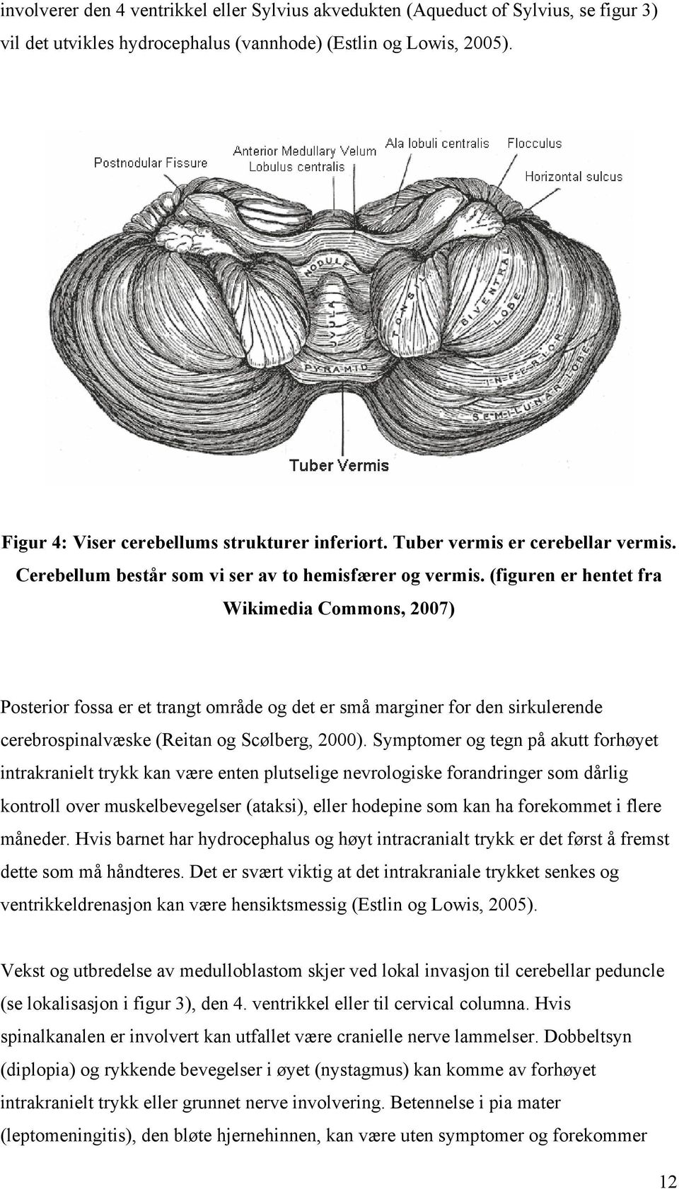 (figuren er hentet fra Wikimedia Commons, 2007) Posterior fossa er et trangt område og det er små marginer for den sirkulerende cerebrospinalvæske (Reitan og Scølberg, 2000).