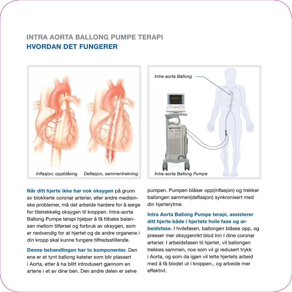 Intra-aorta Ballong Pumpe terapi hjelper å få tilbake balansen mellom tilførsel og forbruk av oksygen, som er nødvendig for at hjertet og de andre organene i din kropp skal kunne fungere