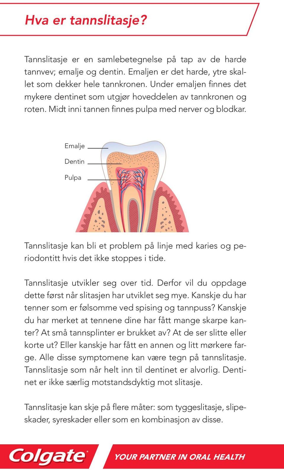 Emalje Dentin Pulpa Tannslitasje kan bli et problem på linje med karies og periodontitt hvis det ikke stoppes i tide. Tannslitasje utvikler seg over tid.