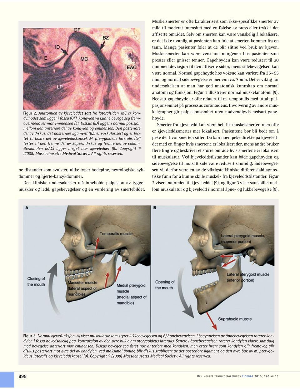 Den posteriore del av diskus, det posteriore ligament (BZ) er vaskularisert og er festet til bakre del av kjeveleddskapsel. M.