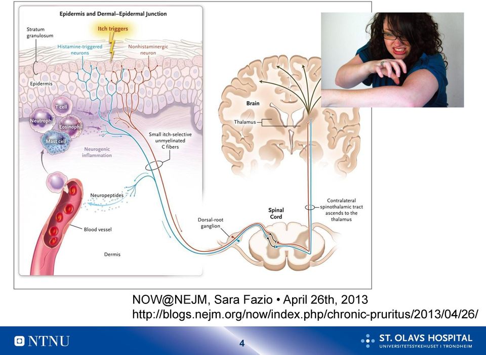 http://blogs.nejm.