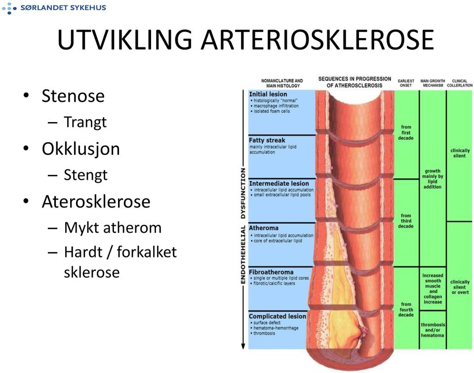 Stengt Aterosklerose Mykt